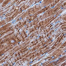 CaM Kinase II was detected in immersion fixed paraffin-embedded sections of human heart using Mouse Anti-Human/Mouse/Rat CaM Kinase II Pan Specific Monoclonal Antibody (Catalog # MAB7280) at 0.5 µg/mL for 1 hour at room temperature. Tissue was stained using DAB (brown) and counterstained with hematoxylin (blue). Specific staining was localized to cytoplasm in cardiomyocytes. View our protocol for IHC Staining with VisUCyte HRP Polymer Detection Reagents.