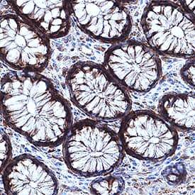 CaM Kinase II was detected in immersion fixed paraffin-embedded sections of human intestine using Mouse Anti-Human/Mouse/Rat CaM Kinase II Pan Specific Monoclonal Antibody (Catalog # MAB7280) at 1.7 µg/mL for 1 hour at room temperature. Tissue was stained using DAB (brown) and counterstained with hematoxylin (blue). Specific staining was localized to cytoplasm in intestinal gland cells. View our protocol for IHC Staining with VisUCyte HRP Polymer Detection Reagents.