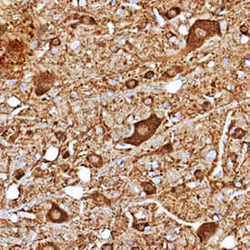 CaM Kinase II was detected in perfusion fixed frozen sections of mouse brain (brainstem) using Mouse Anti-Human/Mouse/Rat CaM Kinase II Pan Specific Monoclonal Antibody (Catalog # MAB7280) at 1.7 µg/mL for 1 hour at room temperature. Tissue was stained using DAB (brown) and counterstained with hematoxylin (blue). Specific staining was localized to cytoplasm in neurons. View our protocol for IHC Staining with VisUCyte HRP Polymer Detection Reagents.
