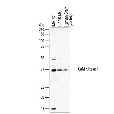 Western Blot CaM Kinase I Antibody