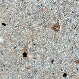 Immunohistochemistry CaM Kinase I Antibody