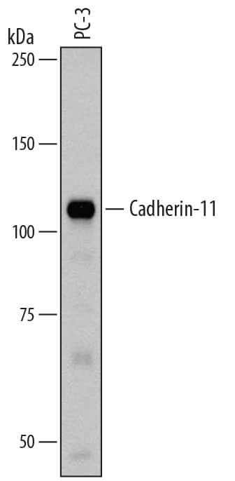 Western blot shows lysates of PC-3 human prostate cancer cell line. PVDF membrane was probed with 1 µg/mL of Goat Anti-Human Cadherin-11 Antigen Affinity-purified Polyclonal Antibody (Catalog # AF1790) followed by HRP-conjugated Anti-Goat IgG Secondary Antibody (Catalog # HAF109). A specific band was detected for Cadherin-11 at approximately 110 kDa (as indicated). This experiment was conducted under reducing conditions and using Immunoblot Buffer Group 1.
