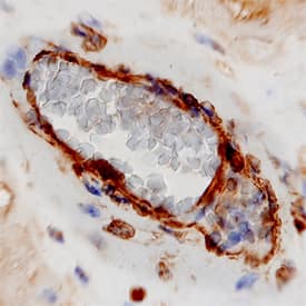 Cadherin-11 was detected in immersion fixed paraffin-embedded sections of human placenta using Mouse Anti-Human Cadherin-11 Monoclonal Antibody (Catalog # MAB1790) at 8 µg/mL overnight at 4 °C. Tissue was stained using the Anti-Mouse HRP-DAB Cell & Tissue Staining Kit (brown; Catalog # CTS002) and counterstained with hematoxylin (blue). View our protocol for Chromogenic IHC Staining of Paraffin-embedded Tissue Sections.