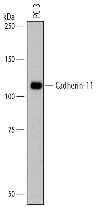 Western Blot Cadherin-11 Antibody (283416)