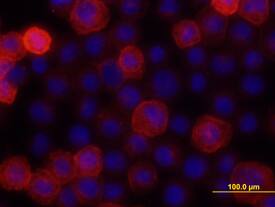 Cadherin-13 was detected in immersion fixed NCI-H460 human large cell lung carcinoma cell line using 10 µg/mL Goat Anti-Human Cadherin-13 Antigen Affinity-purified Polyclonal Antibody (Catalog # AF3264) for 3 hours at room temperature. Cells were stained with the NorthernLights™ 557-conjugated Anti-Goat IgG Secondary Antibody (red; Catalog # NL001) and counter-stained with DAPI (blue). View our protocol for Fluorescent ICC Staining of Cells on Coverslips.