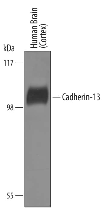 Western Blot Cadherin-13 Antibody [Unconjugated]