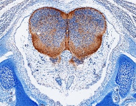 Immunohistochemistry Cadherin-4/R-Cadherin Antibody