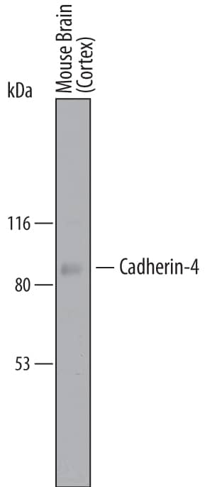 Western Blot Cadherin-4/R-Cadherin Antibody