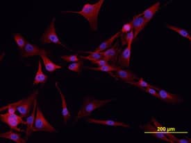 Immunocytochemistry Cadherin-6/KCAD Antibody [Unconjugated]