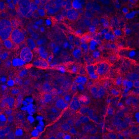 Cadherin-12 was detected in immersion fixed BG01V human embryonic stem cells differentiated into neurons using Rat Anti-Human Cadherin-12 Monoclonal Antibody (Catalog # MAB2240) at 10 µg/mL for 3 hours at room temperature. Cells were stained using the NorthernLights™ 557-conjugated Anti-Rat IgG Secondary Antibody (red; Catalog # NL013) and counterstained with DAPI (blue). Specific staining was localized to cell membranes. View our protocol for Fluorescent ICC Staining of Stem Cells on Coverslips.