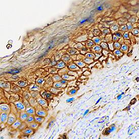 Cadherin-13 was detected in immersion fixed paraffin-embedded sections of human skin using Goat Anti-Human Cadherin-13 Antigen Affinity-purified Polyclonal Antibody (Catalog # AF3264) at 0.1 µg/mL overnight at 4 °C. Tissue was stained using the Anti-Goat HRP-DAB Cell & Tissue Staining Kit (brown; Catalog # CTS008) and counterstained with hematoxylin (blue). Specific staining was localized to plasma membranes of keratinocytes. View our protocol for Chromogenic IHC Staining of Paraffin-embedded Tissue Sections.