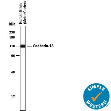 Simple Western lane view shows lysates of human brain (motor cortex) tissue, loaded at 0.2 mg/mL. A specific band was detected for Cadherin-13 at approximately 114 kDa (as indicated) using 10 µg/mL of Goat Anti-Human Cadherin-13 Antigen Affinity-purified Polyclonal Antibody (Catalog # AF3264) followed by 1:50 dilution of HRP-conjugated Anti-Goat IgG Secondary Antibody (Catalog # HAF109). This experiment was conducted under reducing conditions and using the 12-230 kDa separation system.