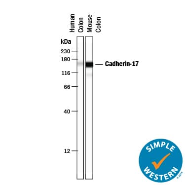 Simple Western lane view shows lysates of human colon tissue and mouse colon tissue, loaded at 0.2 mg/mL. A specific band was detected for Cadherin‑17 at approximately 155 kDa (as indicated) using 5 µg/mL of Goat Anti-Human Cadherin‑17 Antigen Affinity-purified Polyclonal Antibody (Catalog # AF1032) . This experiment was conducted under reducing conditions and using the 12-230 kDa separation system.
