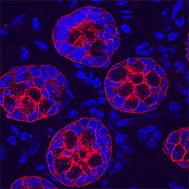 Cadherin-17 was detected in perfusion fixed frozen sections of mouse intestine using Rabbit Anti-Mouse Cadherin-17 Antigen Affinity-purified Polyclonal Antibody (Catalog # AF8524) at 1:250 dilution overnight at 4 °C. Tissue was stained using the NorthernLights™ 557-conjugated Anti-Rabbit IgG Secondary Antibody (red; Catalog # NL004) and counterstained with DAPI (blue). Specific staining was localized to the plasma membrane of glandular cells. View our protocol for Fluorescent IHC Staining of Frozen Tissue Sections.