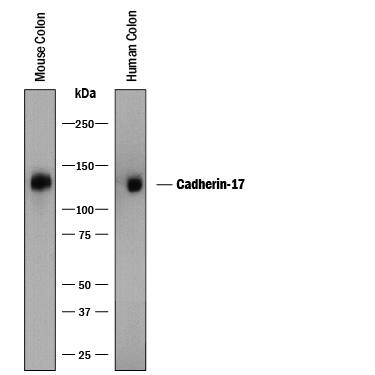Western blot shows lysates of human colon tissue and mouse colon tissue. PVDF membrane was probed with 1:1000 dilution of Rabbit Anti-Human/Mouse Cadherin-17 Antigen Affinity-purified Polyclonal Antibody (Catalog # AF8524) followed by HRP-conjugated Anti-Rabbit IgG Secondary Antibody (Catalog # HAF008). A specific band was detected for Cadherin-17 at approximately 120 kDa (as indicated). This experiment was conducted under reducing conditions and using Immunoblot Buffer Group 1.