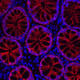 Immunohistochemistry Cadherin-17 Antibody (141713) [Unconjugated]