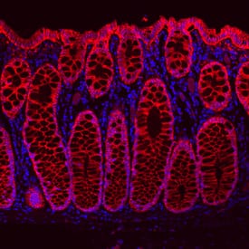 Immunohistochemistry Cadherin-17 Antibody (141713) [Unconjugated]