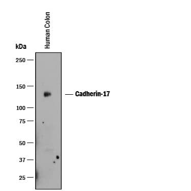 Western Blot Cadherin-17 Antibody (141713) [Unconjugated]