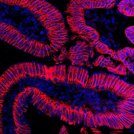 Cadherin-17 was detected in perfusion fixed frozen sections of mouse intestine using Rabbit Anti-Mouse Cadherin-17 Monoclonal Antibody (Catalog # MAB8524) at 1.7 µg/mL overnight at 4 °C. Tissue was stained using the NorthernLights™ 557-conjugated Anti-Rabbit IgG Secondary Antibody (red; Catalog # NL004) and counterstained with DAPI (blue). Specific staining was localized to plasma membranes. View our protocol for Fluorescent IHC Staining of Frozen Tissue Sections.