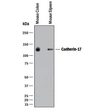 Western blot shows lysates of mouse colon tissue and mouse spleen tissue. PVDF membrane was probed with 0.1 µg/mL of Rabbit Anti-Mouse Cadherin-17 Monoclonal Antibody (Catalog # MAB8524) followed by HRP-conjugated Anti-Rabbit IgG Secondary Antibody (Catalog # HAF008). A specific band was detected for Cadherin-17 at approximately 130 kDa (as indicated). This experiment was conducted under reducing conditions and using Immunoblot Buffer Group 1.