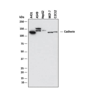 Western blot shows lysates of A431 human epithelial carcinoma cell line, A549 human lung carcinoma cell line, HepG2 human hepatocellular carcinoma cell line, MCF-7 human breast cancer cell line, and C2C12 mouse myoblast cell line. PVDF membrane was probed with 1 µg/mL of Mouse Anti-Human/Mouse Cadherin Pan Specific Monoclonal Antibody (Catalog # MAB18385) followed by HRP-conjugated Anti-Mouse IgG Secondary Antibody (HAF018). Specific bands were detected for Cadherin at approximately 135 kDa (as indicated). This experiment was conducted under reducing conditions and using Immunoblot Buffer Group 1.