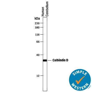 Simple Western Calbindin D/S100G Antibody [Unconjugated]
