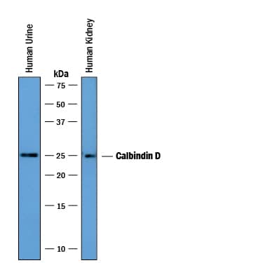 Western Blot Calbindin D/S100G Antibody [Unconjugated]