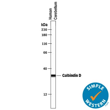 Simple Western lane view shows lysates of human brain (cerebellum) tissue, loaded at 0.2 mg/mL. A specific band was detected for Calbindin D at approximately 32 kDa (as indicated) using 10 µg/mL of Mouse Anti-Human Calbindin D Monoclonal Antibody (Catalog # MAB3320) . This experiment was conducted under reducing conditions and using the 12-230 kDa separation system.