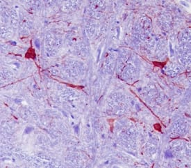 Calbindin D was detected in perfusion fixed paraffin-embedded sections of rat brainstem (medulla) using 25 µg/mL Mouse Anti-Human Calbindin D Monoclonal Antibody (Catalog # MAB3320) overnight at 4 °C. Tissue was stained with the Anti-Mouse HRP-AEC Cell & Tissue Staining Kit (red; Catalog # CTS003) and counterstained with hematoxylin (blue). View our protocol for Chromogenic IHC Staining of Paraffin-embedded Tissue Sections.