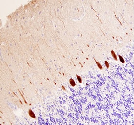 Calbindin D was detected in immersion fixed paraffin-embedded sections of human brain (cerebellum) using 25 µg/mL Mouse Anti-Human Calbindin D Monoclonal Antibody (Catalog # MAB3320) overnight at 4 °C. Tissue was stained with the Anti-Mouse HRP-DAB Cell & Tissue Staining Kit (brown; Catalog # CTS002) and counterstained with hematoxylin (blue). View our protocol for Chromogenic IHC Staining of Paraffin-embedded Tissue Sections.