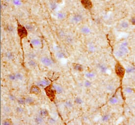Calbindin D was detected in perfusion fixed frozen sections of rat brain (hypothalamus) using 25 µg/mL Mouse Anti-Human Calbindin D Monoclonal Antibody (Catalog # MAB3320) overnight at 4 °C. Tissue was stained with the Anti-Mouse HRP-DAB Cell & Tissue Staining Kit (brown; Catalog # CTS002) and counterstained with hematoxylin (blue). View our protocol for Chromogenic IHC Staining of Frozen Tissue Sections.