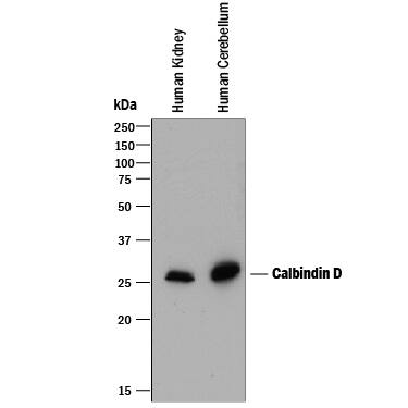 Western blot shows lysates of human kidney tissue and human brain (cerebellum) tissue. PVDF membrane was probed with 0.25 µg/mL of Mouse Anti-Human Calbindin D Monoclonal Antibody (Catalog # MAB3320) followed by HRP-conjugated Anti-Mouse IgG Secondary Antibody (Catalog # HAF018). A specific band was detected for Calbindin D at approximately 28 kDa (as indicated). This experiment was conducted under reducing conditions and using Immunoblot Buffer Group 1.
