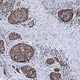 Immunohistochemistry Calcitonin R Antibody (462815) [Unconjugated]