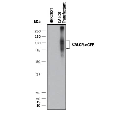 Western Blot Calcitonin R Antibody (462815) [Unconjugated]