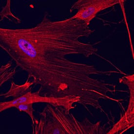 Caldesmon/CALD1 was detected in immersion fixed WI-38 human lung fibroblast cell line using Mouse Anti-Human Caldesmon/CALD1 Monoclonal Antibody (Catalog # MAB7569) at 10 µg/mL for 3 hours at room temperature. Cells were stained using the NorthernLights™ 557-conjugated Anti-Mouse IgG Secondary Antibody (red; NL007) and counter-stained with DAPI (blue). Specific staining was localized to cytoskeleton. View our protocol for Fluorescent ICC Staining of Cells on Coverslips.