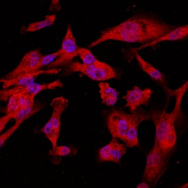 Calponin 1 was detected in immersion fixed MDA-MB-231 human breast cancer cell line using Sheep Anti-Human Calponin 1 Antigen Affinity-purified Polyclonal Antibody (Catalog # AF7900) at 10 µg/mL for 3 hours at room temperature. Cells were stained using the NorthernLights™ 557-conjugated Anti-Sheep IgG Secondary Antibody (red; Catalog # NL010) and counterstained with DAPI (blue). Specific staining was localized to cytoplasm. View our protocol for Fluorescent ICC Staining of Cells on Coverslips.