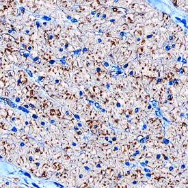 Calponin 1 was detected in immersion fixed paraffin-embedded sections of human small intestine using Sheep Anti-Human Calponin 1 Antigen Affinity-purified Polyclonal Antibody (Catalog # AF7900) at 15 µg/mL overnight at 4 °C. Tissue was stained using the Anti-Sheep HRP-DAB Cell & Tissue Staining Kit (brown; Catalog # CTS019) and counterstained with hematoxylin (blue). Specific staining was localized to smooth muscle cells. View our protocol for Chromogenic IHC Staining of Paraffin-embedded Tissue Sections.