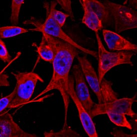 Calponin 1 was detected in immersion fixed MDA-MD-231 human breast cancer cell line using Mouse Anti-Human Calponin 1 Monoclonal Antibody (Catalog # MAB7900) at 10 µg/mL for 3 hours at room temperature. Cells were stained using the Northern-Lights™ 557-conjugated Anti-Mouse IgG Secondary Antibody (red; Catalog # NL007) and counterstained with DAPI (blue). Specific staining was localized to cytoplasm. View our protocol for Fluorescent ICC Staining of Cells on Coverslips.
