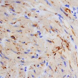 Calponin 1 was detected in immersion fixed paraffin-embedded sections of human small intestine using Mouse Anti-Human Calponin 1 Monoclonal Antibody (Catalog # MAB7900) at 15 µg/mL overnight at 4 °C. Before incubation with the primary antibody, tissue was subjected to heat-induced epitope retrieval using Antigen Retrieval Reagent-Basic (Catalog # CTS013). Tissue was stained using the Anti-Mouse HRP-DAB Cell & Tissue Staining Kit (brown; Catalog # CTS002) and counterstained with hematoxylin (blue). Specific staining was localized to the cytoplasm of smooth muscle cells. View our protocol for Chromogenic IHC Staining of Paraffin-embedded Tissue Sections.
