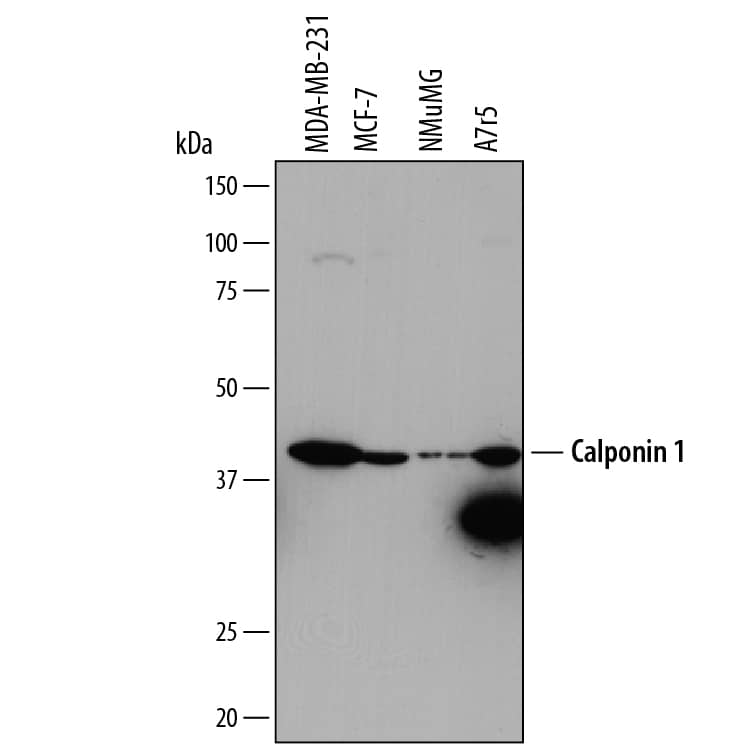 Western blot shows lysates of MDA-MB-231 human breast cancer cell line, MCF-7 human breast cancer cell line, NMuMG mouse mammary gland epithelial cell line, and A7r5 rat thoracic aortic smooth muscle cell line. PVDF membrane was probed with 1 µg/mL of Mouse Anti-Human Calponin 1 Monoclonal Antibody (Catalog # MAB7900) followed by HRP-conjugated Anti-Mouse IgG Secondary Antibody (Catalog # HAF007). A specific band was detected for Calponin 1 at approximately 40 kDa (as indicated). This experiment was conducted under reducing conditions and using Immunoblot Buffer Group 1.