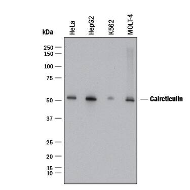 Western blot shows lysates of HeLa human cervical epithelial carcinoma cell line, HepG2 human hepatocellular carcinoma cell line, K562 human chronic myelogenous leukemia cell line, and MOLT-4 human acute lymphoblastic leukemia cell line. PVDF membrane was probed with 1 µg/mL of Mouse Anti-Human Calreticulin Monoclonal Antibody (Catalog # MAB38982) followed by HRP-conjugated Anti-Mouse IgG Secondary Antibody (Catalog # HAF018). A specific band was detected for Calreticulin at approximately 60 kDa (as indicated). This experiment was conducted under reducing conditions and using Immunoblot Buffer Group 1.