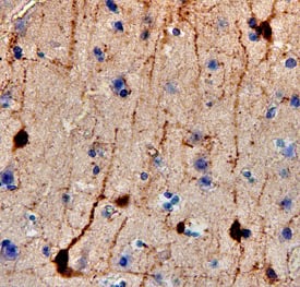 Immunohistochemistry Calretinin Antibody [Unconjugated]