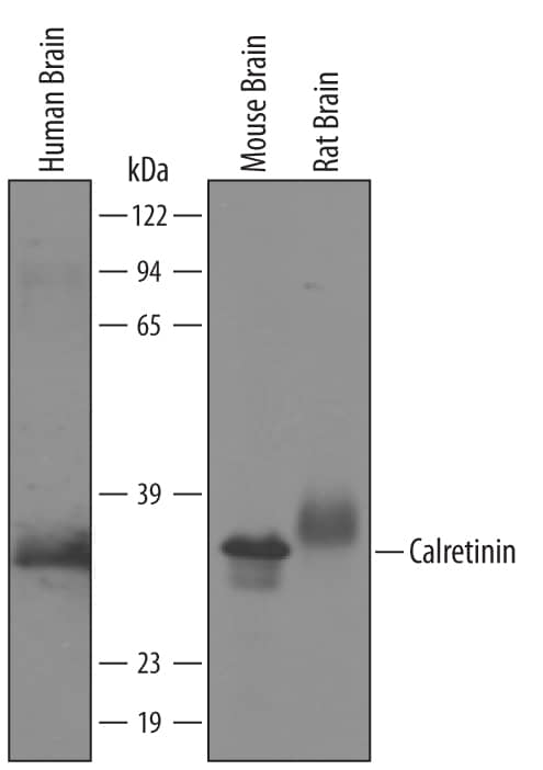Western Blot Calretinin Antibody [Unconjugated]