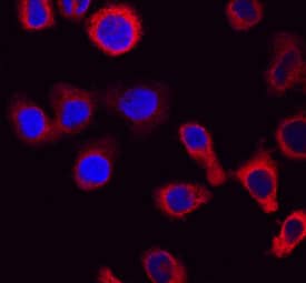 CapG was detected in immersion fixed U937 human histiocytic lymphoma cell line using Sheep Anti-Human CapG Antigen Affinity-purified Polyclonal Antibody (Catalog # AF7177) at 10 µg/mL for 3 hours at room temperature. Cells were stained using the NorthernLights™ 557-conjugated Anti-Sheep IgG Secondary Antibody (red; Catalog # NL010) and counterstained with DAPI (blue). Specific staining was localized to cytoplasm. View our protocol for Fluorescent ICC Staining of Non-adherent Cells.