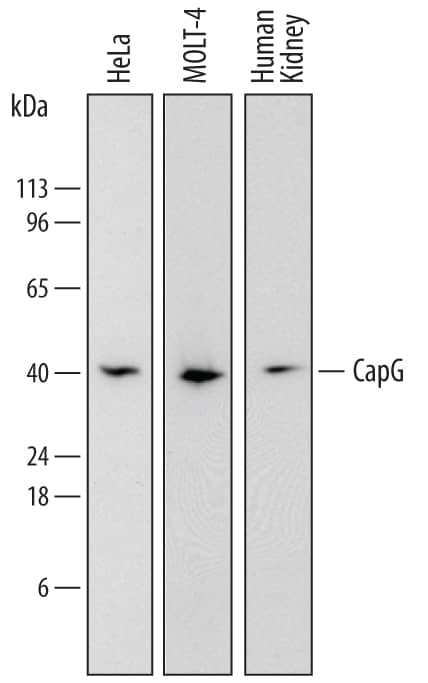 Western blot shows lysates of HeLa human cervical epithelial carcinoma cell line, MOLT-4 human acute lymphoblastic leukemia cell line, and human kidney tissue. PVDF membrane was probed with 0.2 µg/mL of Sheep Anti-Human CapG Antigen Affinity-purified Polyclonal Antibody (Catalog # AF7177) followed by HRP-conjugated Anti-Sheep IgG Secondary Antibody (Catalog # HAF016). A specific band was detected for CapG at approximately 41 kDa (as indicated). This experiment was conducted under reducing conditions and using Immunoblot Buffer Group 1.