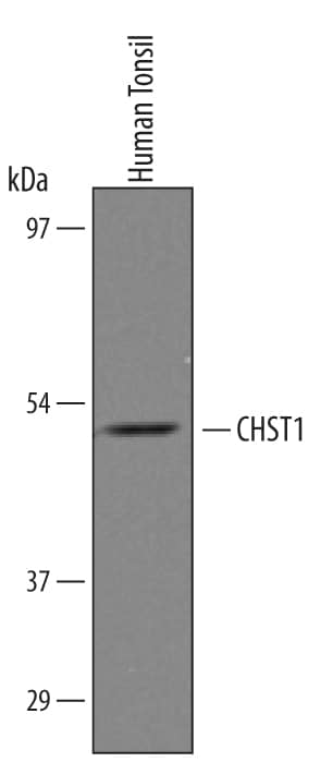 Western Blot Carbohydrate Sulfotransferase 1/CHST1/KS6ST Antibody