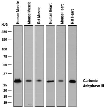 Western Blot Carbonic Anhydrase III/CA3 Antibody [Unconjugated]