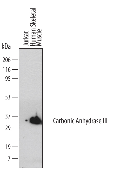 Western blot shows lysates of human skeletal muscle tissue. PVDF membrane was probed with 2 µg/mL of Mouse Anti-Human Carbonic Anhydrase III Monoclonal Antibody (Catalog # MAB2185) followed by HRP-conjugated Anti-Mouse IgG Secondary Antibody (Catalog # HAF007). A specific band was detected for Carbonic Anhydrase III at approximately 33 kDa (as indicated). This experiment was conducted under reducing conditions and using Immunoblot Buffer Group 1.