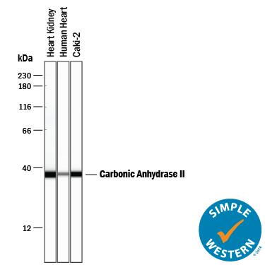 Simple Western Carbonic Anhydrase II/CA2 Antibody [Unconjugated]