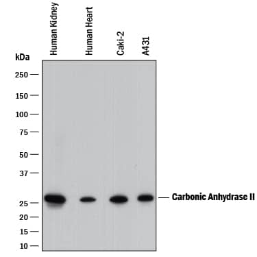 Western Blot Carbonic Anhydrase II/CA2 Antibody [Unconjugated]
